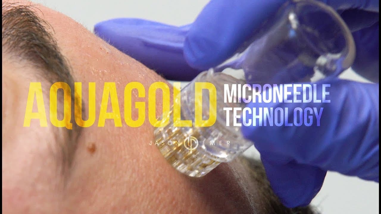 Watch a microchannel infusion therapy procedure video