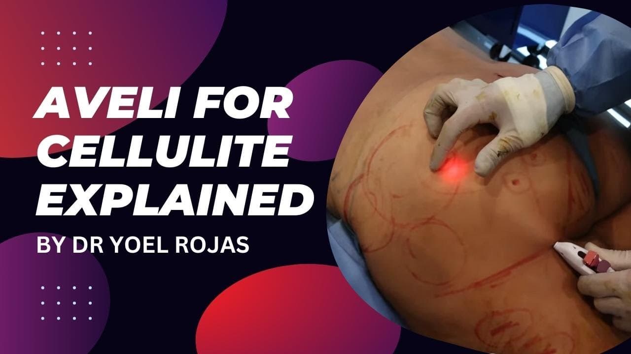 Watch a avéli procedure video