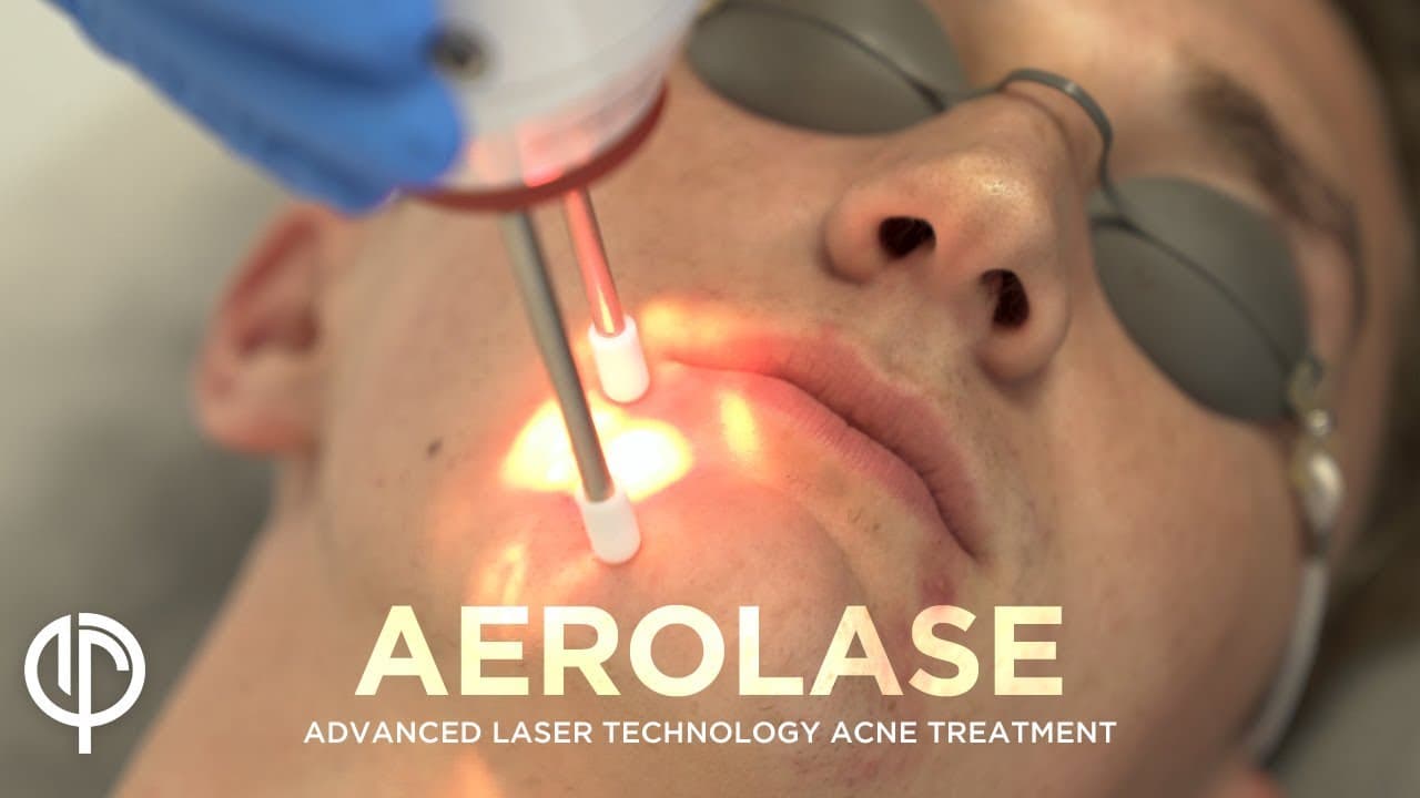 Watch a hyperpigmentation & melasma procedure video