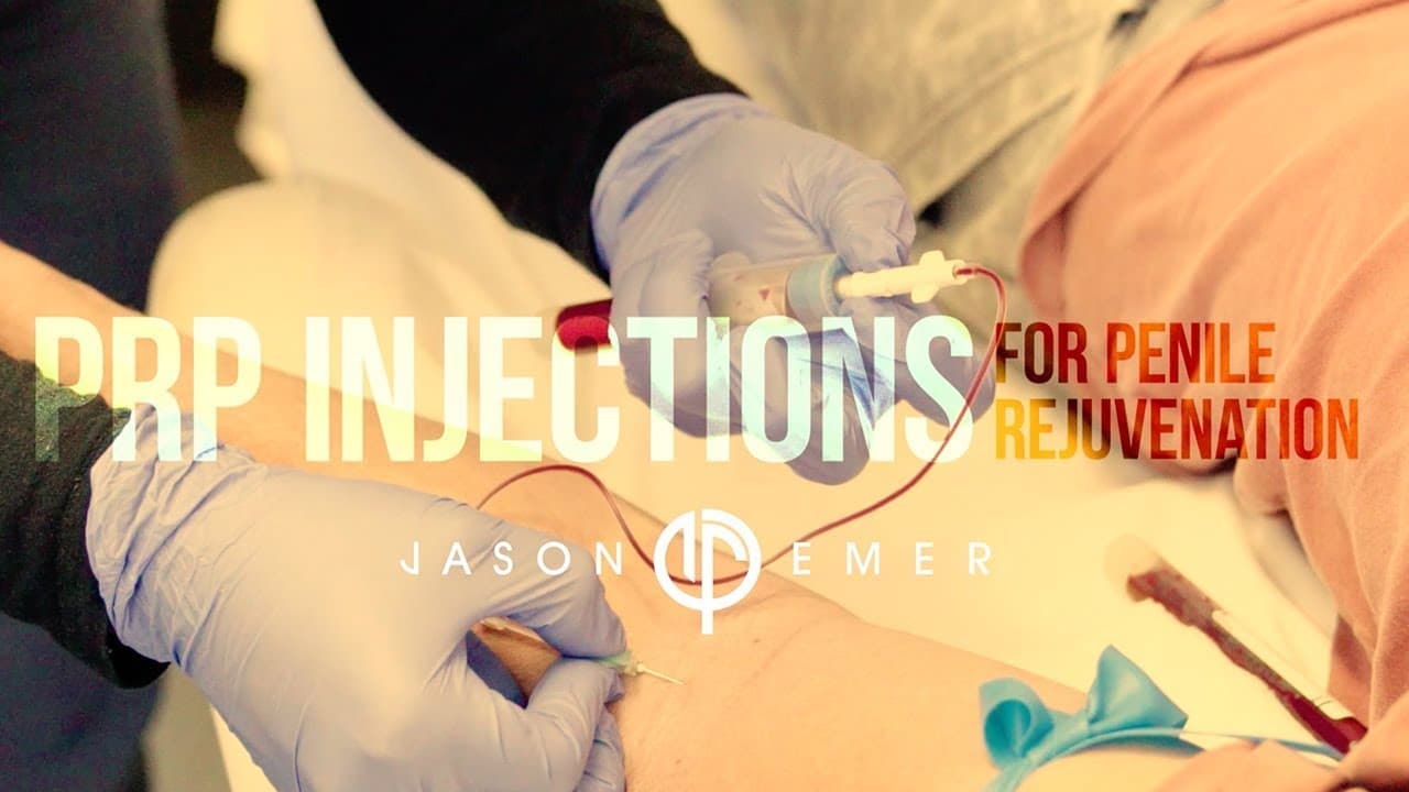 Watch a autologous fat grafting provides permanent volumization, shaping, sculpting, and muscular definition enhancements procedure video