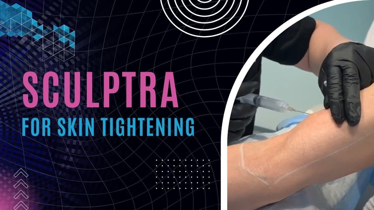 Watch a dr. jason emer: sculptra procedure video