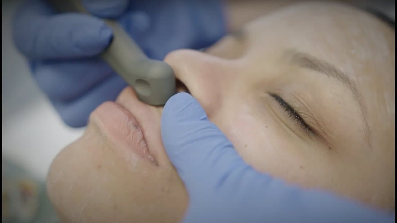 Watch a saltfacial procedure video