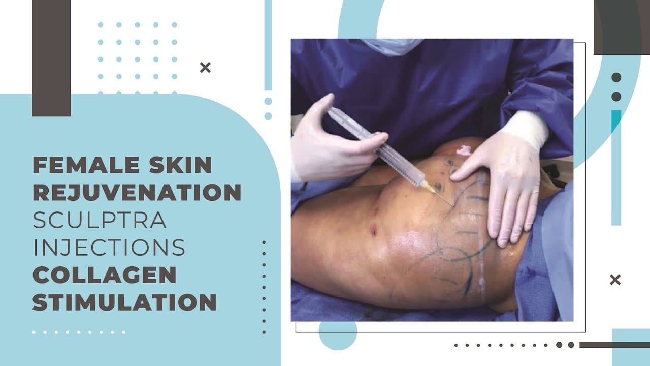 Watch a dr. jason emer: sculptra procedure video