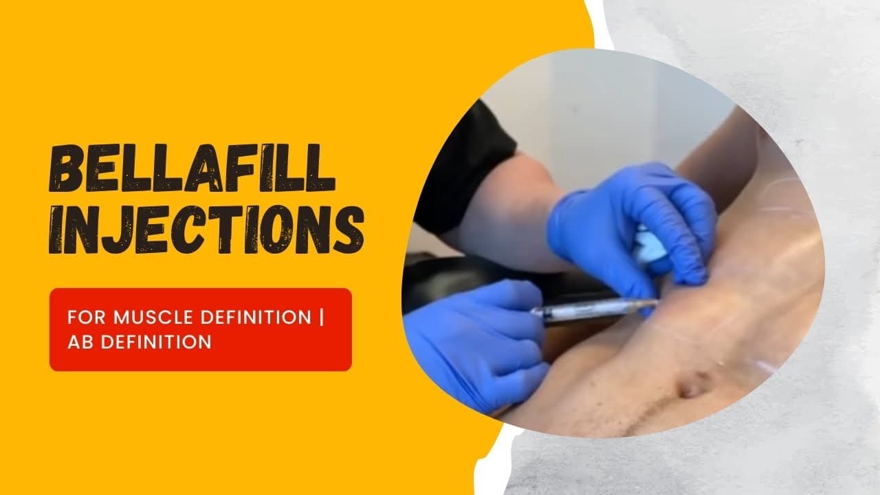 Watch a dr. jason emer: trusculpt flex system procedure video