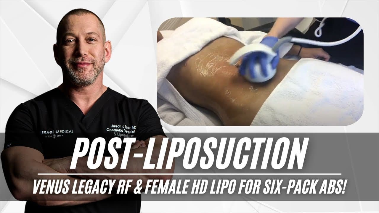 Watch a hd liposculpture for men procedure video