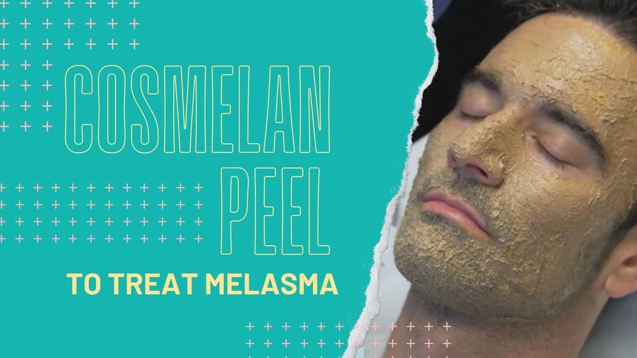 Watch a cosmelan & enlighten peels procedure video