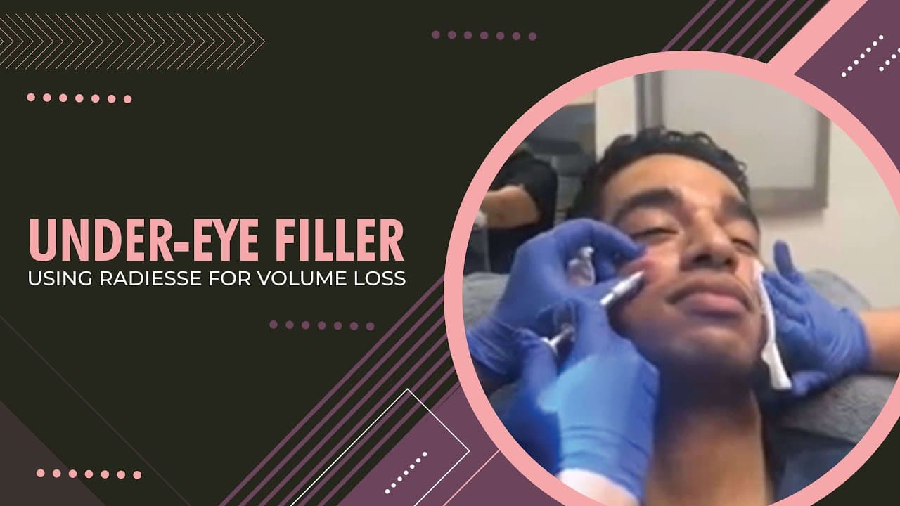 Watch a rejuvenate with injectable fillers procedure video