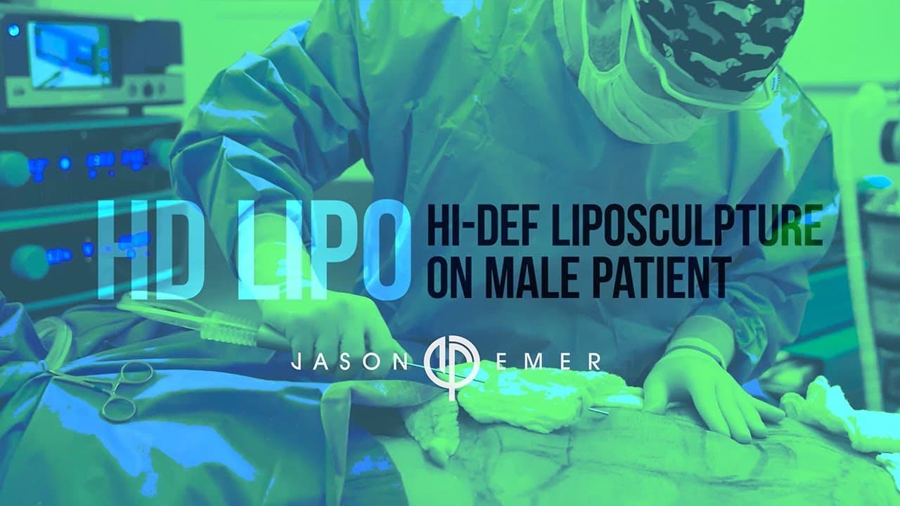 Watch a high definition liposuction procedure video