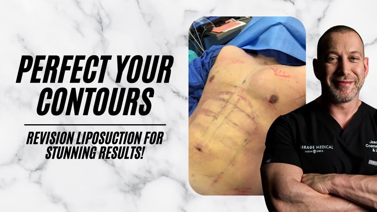 Watch a abdominal lipo for men lp procedure video