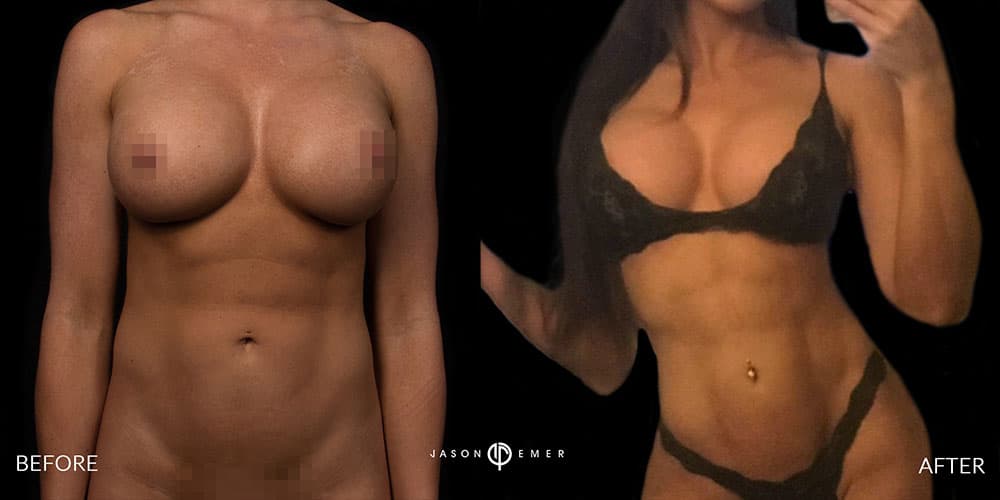 Abs Female Gallery