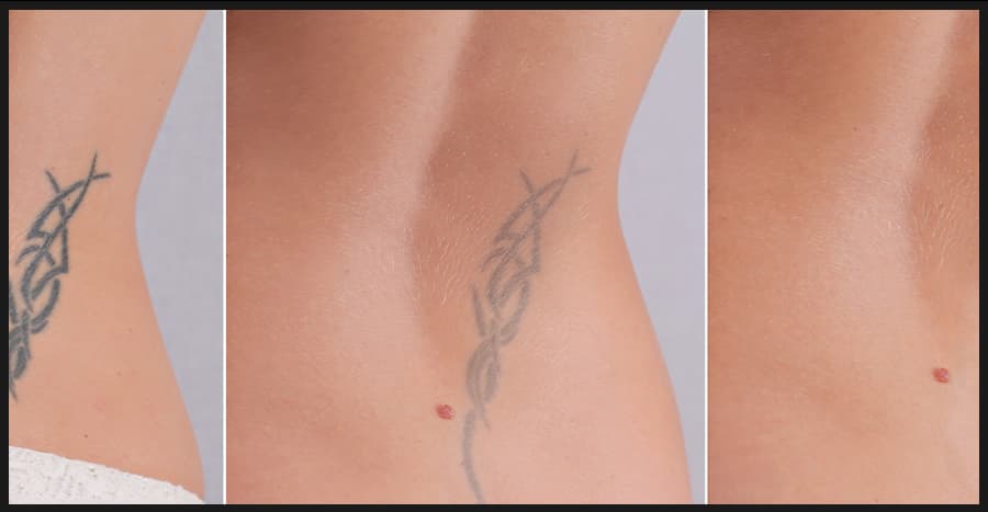 Patient before and after