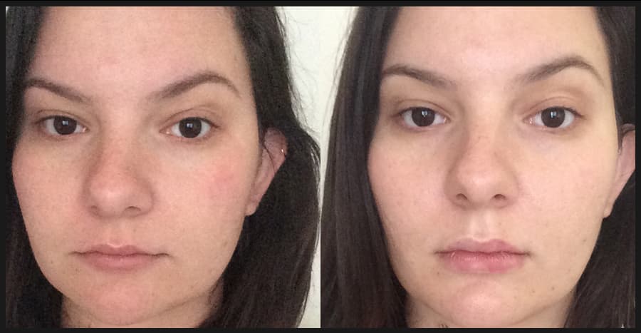 Patient before and after