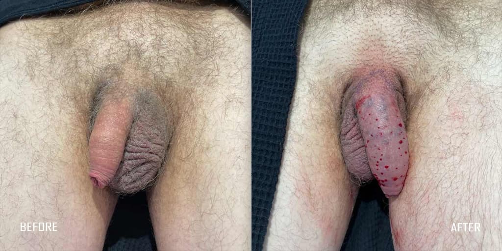 Patient before and after