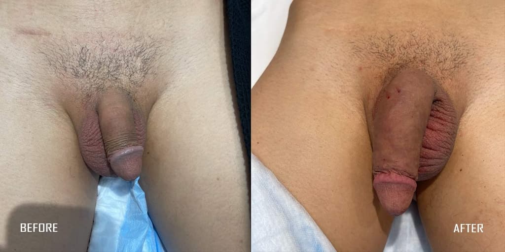 Patient before and after