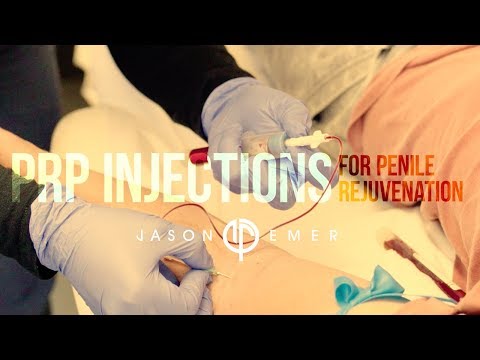 PLATELET-RICH PLASMA (PRP), Cosmetic Dermatologist Dr. Jason Emer