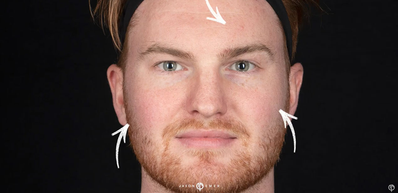 REVEPEEL, Cosmetic Dermatologist Dr. Jason Emer