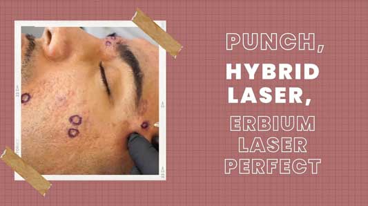 laser-derma