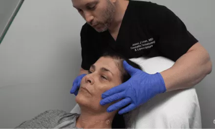 FEMALE FACIAL SCULPTING OF THE CHEEKS, NASOLABIAL FOLDS AND CHIN WITH FILLERS