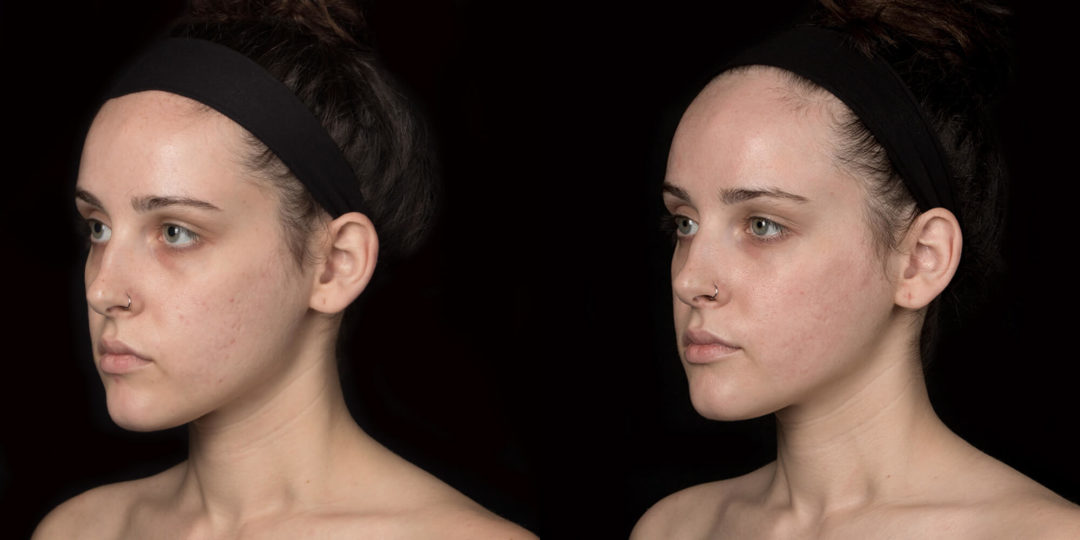 1124-2-1080x540